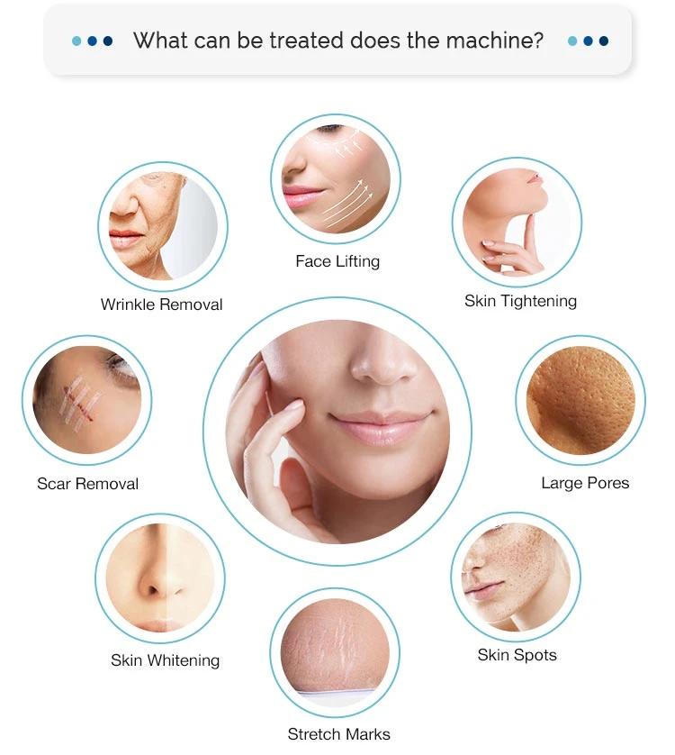 fractional rf skin resurfacing machine fractional rf skin resurfacing machine